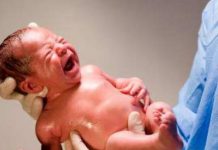 ОСЛОЖНЕНИЯ