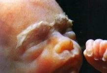 8 МЕСЯЦЕВ БЕРЕМЕННОСТИ