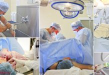 КЕСАРЕВО СЕЧЕНИЕ