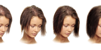 Что делать при выпадении волос, причины, лечение