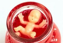 Замершая беременность диагностика и лечение