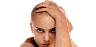 Выпадение волос у женщин причины и лечение